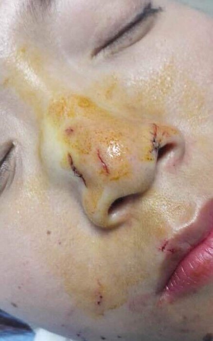 ???? ???  ??? ????? ????? ???????