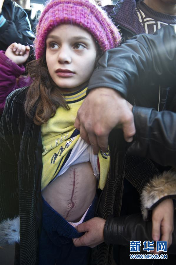 ????? ??????:??? ??? ????? ?? ????? ?? ?????.. ??? ???? ?????? ???????