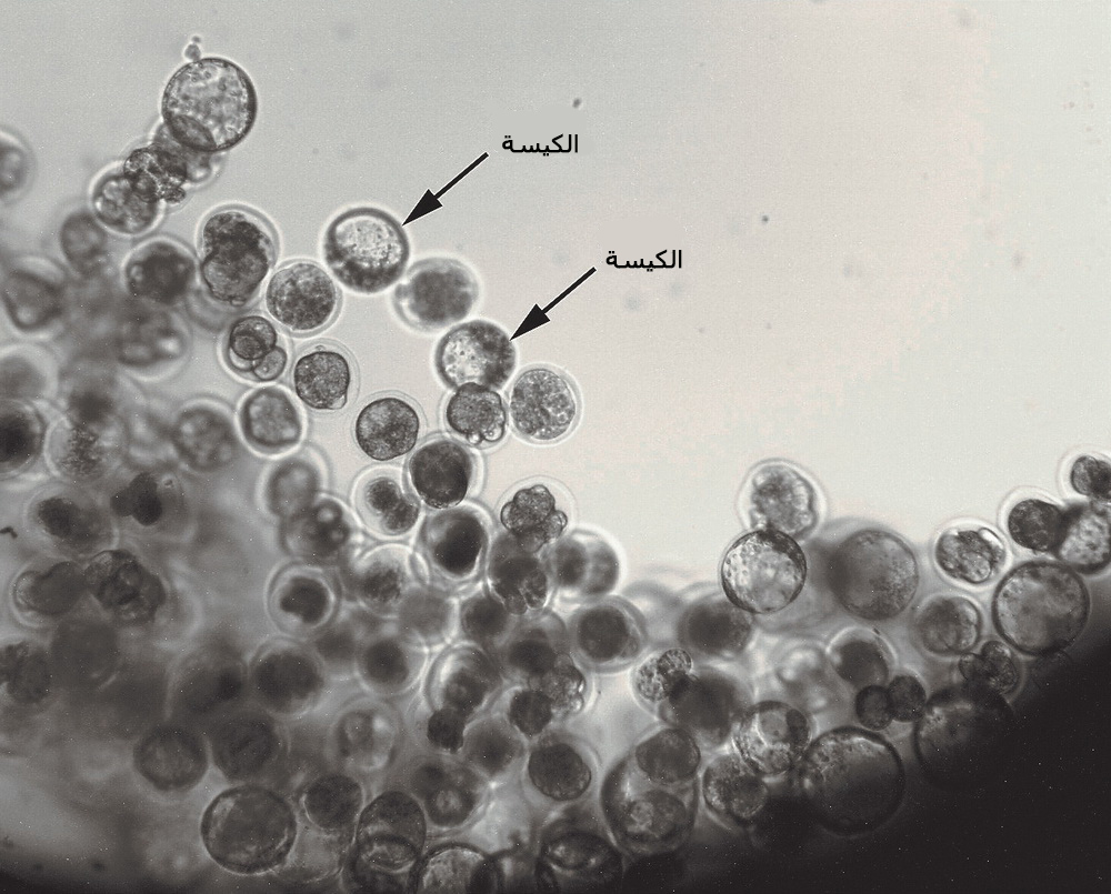 ????? ?????? ?????? ?? ????? ????? ?????? ?? ??????