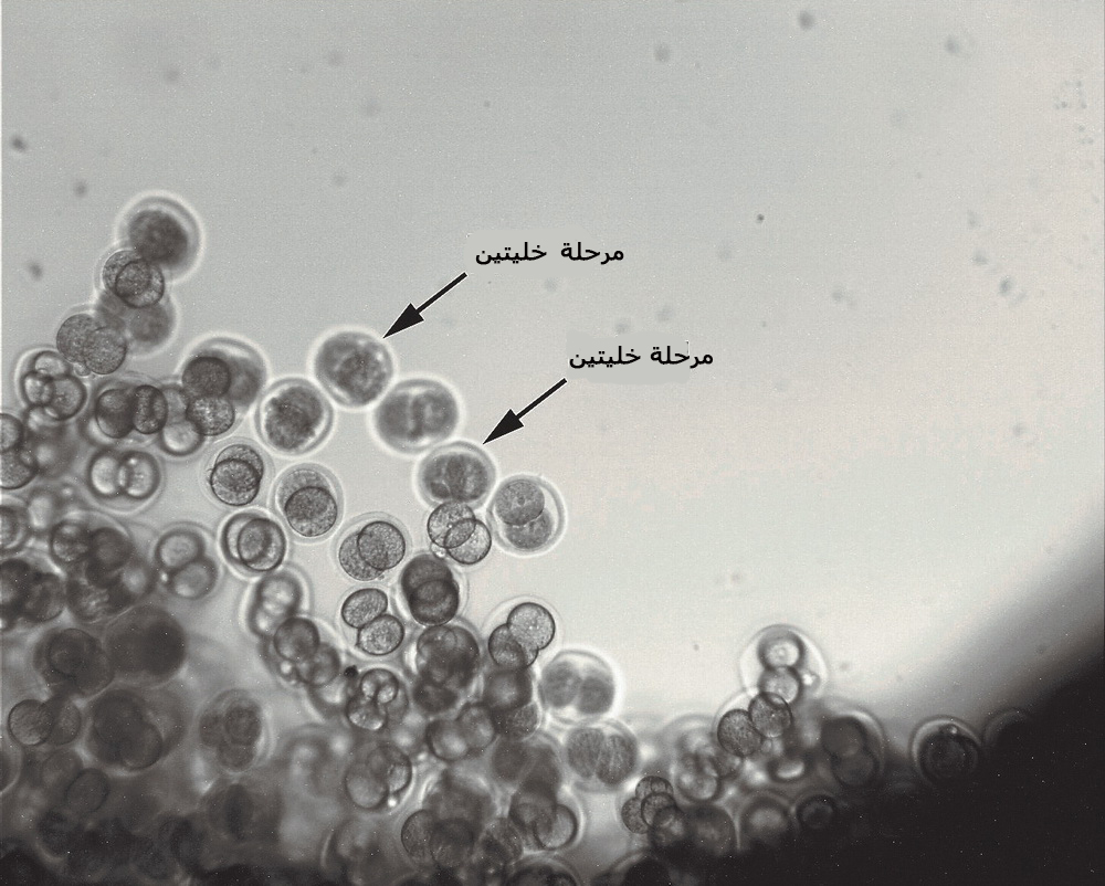 ????? ?????? ?????? ?? ????? ????? ?????? ?? ??????